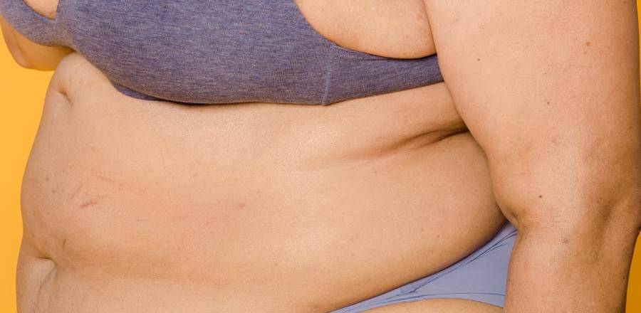 How to Get Rid of Underboob Fat 3